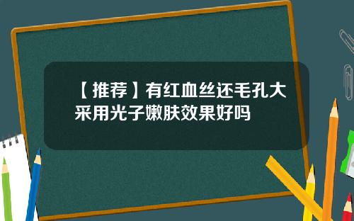 【推荐】有红血丝还毛孔大采用光子嫩肤效果好吗