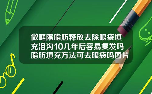 做眶隔脂肪释放去除眼袋填充泪沟10几年后容易复发吗脂肪填充方法可去眼袋吗图片