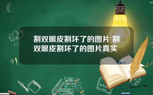割双眼皮割坏了的图片 割双眼皮割坏了的图片真实