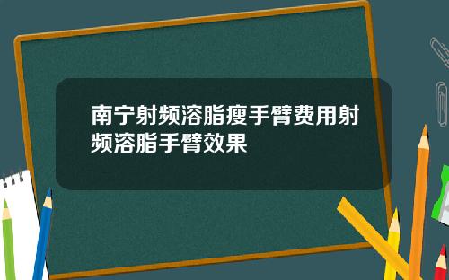 南宁射频溶脂瘦手臂费用射频溶脂手臂效果