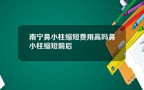 南宁鼻小柱缩短费用高吗鼻小柱缩短前后