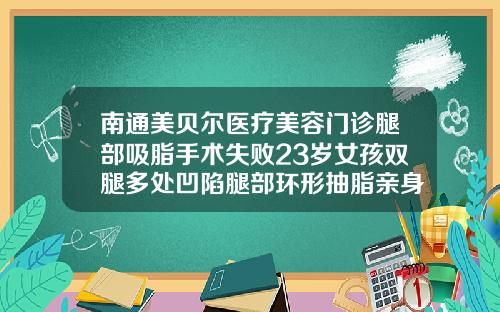 南通美贝尔医疗美容门诊腿部吸脂手术失败23岁女孩双腿多处凹陷腿部环形抽脂亲身经历