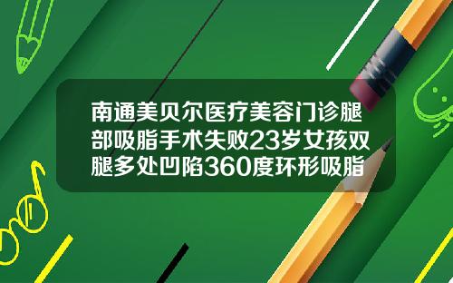 南通美贝尔医疗美容门诊腿部吸脂手术失败23岁女孩双腿多处凹陷360度环形吸脂