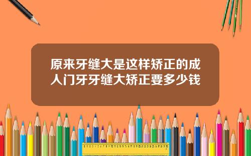 原来牙缝大是这样矫正的成人门牙牙缝大矫正要多少钱