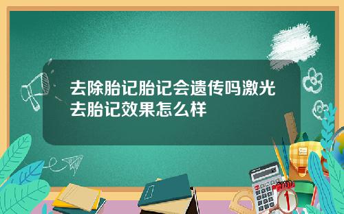 去除胎记胎记会遗传吗激光去胎记效果怎么样