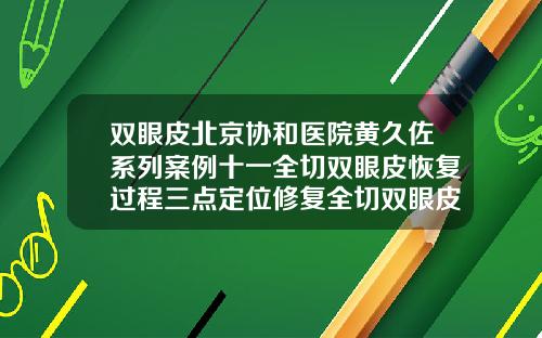 双眼皮北京协和医院黄久佐系列案例十一全切双眼皮恢复过程三点定位修复全切双眼皮案例