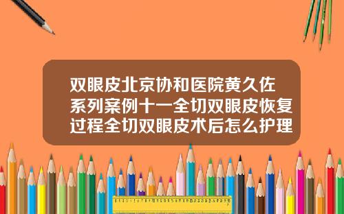 双眼皮北京协和医院黄久佐系列案例十一全切双眼皮恢复过程全切双眼皮术后怎么护理恢复快