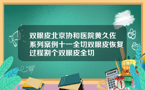 双眼皮北京协和医院黄久佐系列案例十一全切双眼皮恢复过程割个双眼皮全切