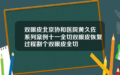 双眼皮北京协和医院黄久佐系列案例十一全切双眼皮恢复过程割个双眼皮全切