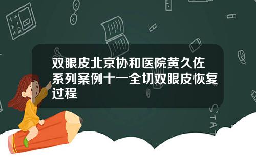 双眼皮北京协和医院黄久佐系列案例十一全切双眼皮恢复过程
