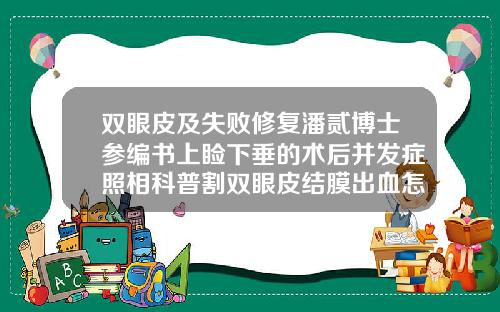 双眼皮及失败修复潘贰博士参编书上睑下垂的术后并发症照相科普割双眼皮结膜出血怎么回事