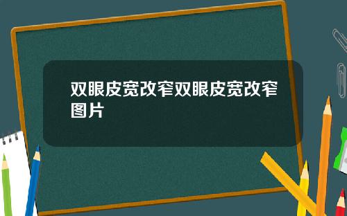 双眼皮宽改窄双眼皮宽改窄图片
