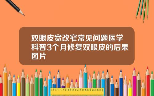 双眼皮宽改窄常见问题医学科普3个月修复双眼皮的后果图片