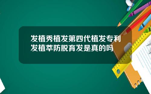 发植秀植发第四代植发专利发植萃防脱育发是真的吗