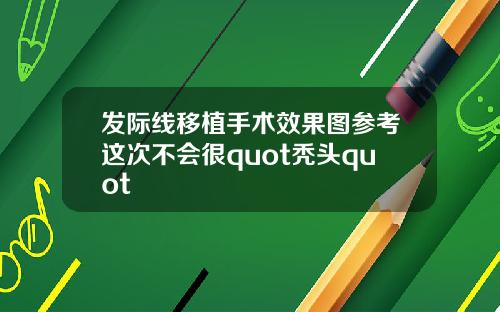 发际线移植手术效果图参考这次不会很quot秃头quot