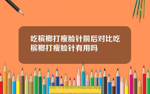 吃槟榔打瘦脸针前后对比吃槟榔打瘦脸针有用吗