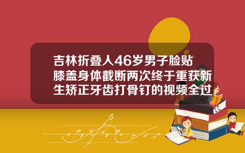 吉林折叠人46岁男子脸贴膝盖身体截断两次终于重获新生矫正牙齿打骨钉的视频全过程