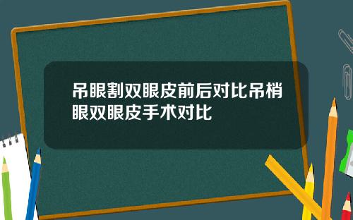 吊眼割双眼皮前后对比吊梢眼双眼皮手术对比