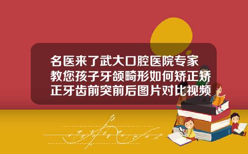 名医来了武大口腔医院专家教您孩子牙颌畸形如何矫正矫正牙齿前突前后图片对比视频