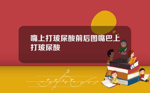 嘴上打玻尿酸前后图嘴巴上打玻尿酸