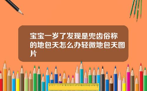宝宝一岁了发现是兜齿俗称的地包天怎么办轻微地包天图片