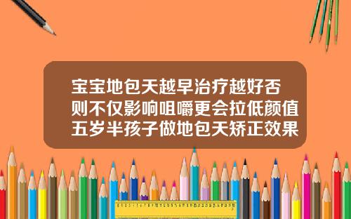 宝宝地包天越早治疗越好否则不仅影响咀嚼更会拉低颜值五岁半孩子做地包天矫正效果