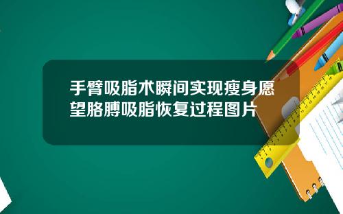 手臂吸脂术瞬间实现瘦身愿望胳膊吸脂恢复过程图片