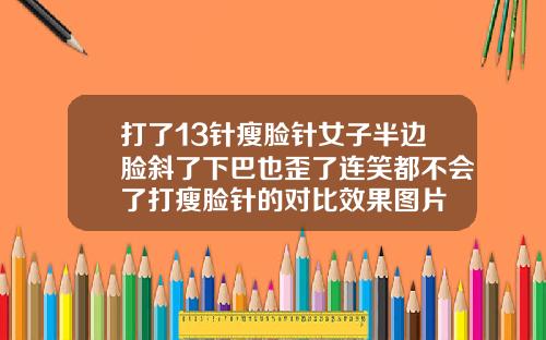 打了13针瘦脸针女子半边脸斜了下巴也歪了连笑都不会了打瘦脸针的对比效果图片