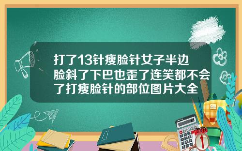 打了13针瘦脸针女子半边脸斜了下巴也歪了连笑都不会了打瘦脸针的部位图片大全