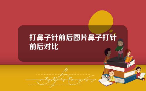 打鼻子针前后图片鼻子打针前后对比