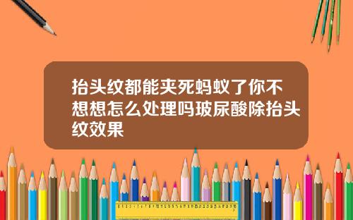 抬头纹都能夹死蚂蚁了你不想想怎么处理吗玻尿酸除抬头纹效果