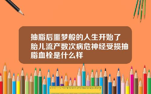 抽脂后噩梦般的人生开始了胎儿流产数次病危神经受损抽脂血栓是什么样