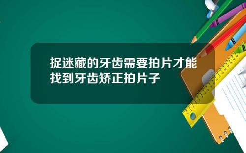 捉迷藏的牙齿需要拍片才能找到牙齿矫正拍片子