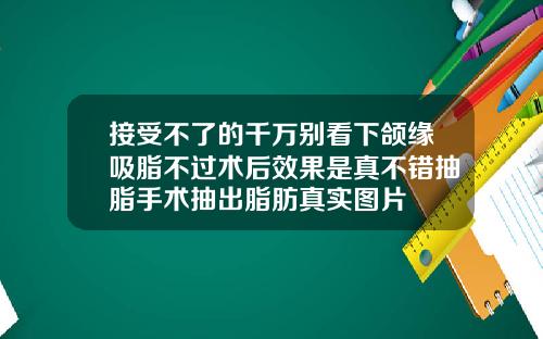 接受不了的千万别看下颌缘吸脂不过术后效果是真不错抽脂手术抽出脂肪真实图片