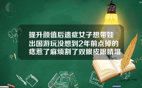 提升颜值后遗症女子想带娃出国游玩没想到2年前点掉的痣惹了麻烦割了双眼皮眼睛塌坑