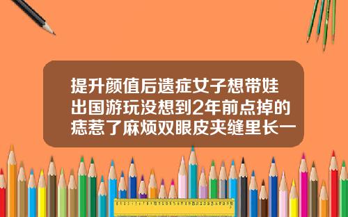 提升颜值后遗症女子想带娃出国游玩没想到2年前点掉的痣惹了麻烦双眼皮夹缝里长一颗痣女人