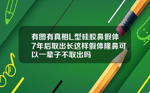 有图有真相L型硅胶鼻假体7年后取出长这样假体隆鼻可以一辈子不取出吗