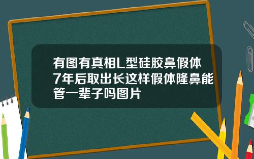 有图有真相L型硅胶鼻假体7年后取出长这样假体隆鼻能管一辈子吗图片