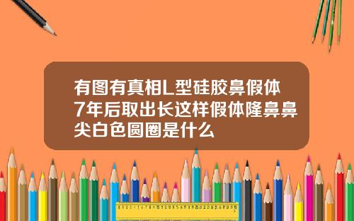 有图有真相L型硅胶鼻假体7年后取出长这样假体隆鼻鼻尖白色圆圈是什么