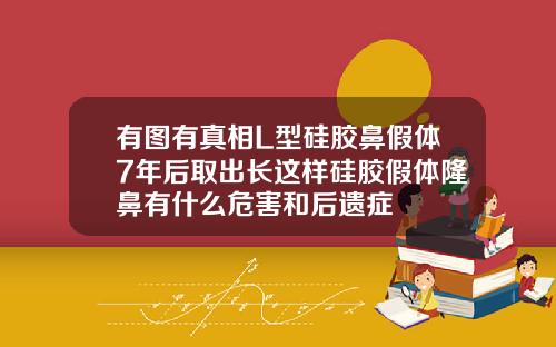 有图有真相L型硅胶鼻假体7年后取出长这样硅胶假体隆鼻有什么危害和后遗症