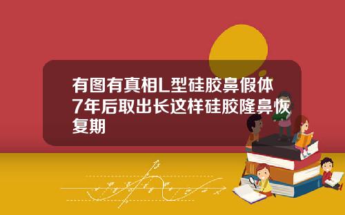 有图有真相L型硅胶鼻假体7年后取出长这样硅胶隆鼻恢复期