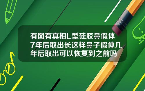 有图有真相L型硅胶鼻假体7年后取出长这样鼻子假体几年后取出可以恢复到之前吗