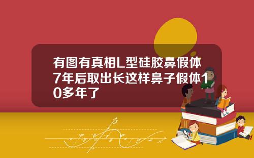 有图有真相L型硅胶鼻假体7年后取出长这样鼻子假体10多年了