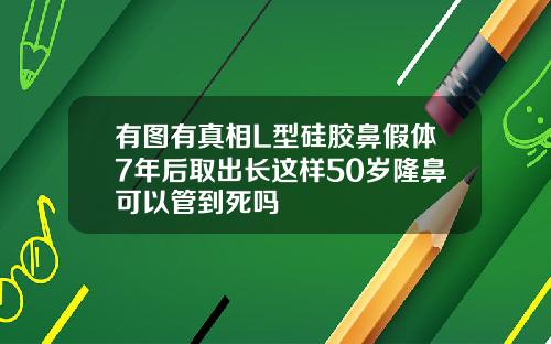 有图有真相L型硅胶鼻假体7年后取出长这样50岁隆鼻可以管到死吗