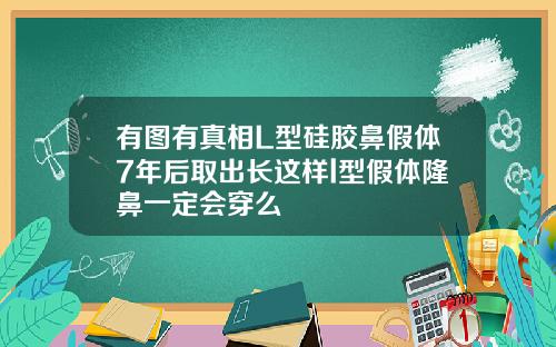 有图有真相L型硅胶鼻假体7年后取出长这样l型假体隆鼻一定会穿么
