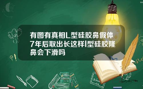 有图有真相L型硅胶鼻假体7年后取出长这样l型硅胶隆鼻会下滑吗