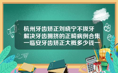杭州牙齿矫正刘晓宁不拔牙解决牙齿拥挤的正畸病例合集一临安牙齿矫正大概多少钱一次