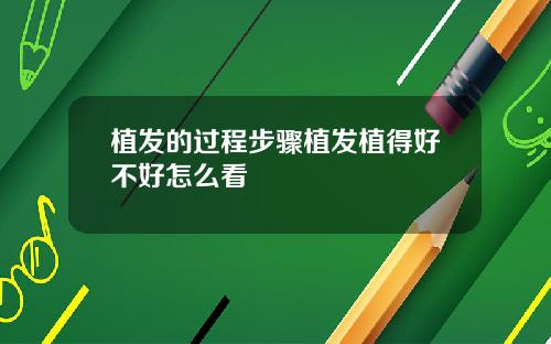 植发的过程步骤植发植得好不好怎么看