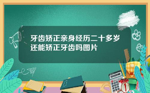 牙齿矫正亲身经历二十多岁还能矫正牙齿吗图片