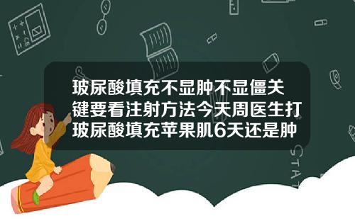 玻尿酸填充不显肿不显僵关键要看注射方法今天周医生打玻尿酸填充苹果肌6天还是肿